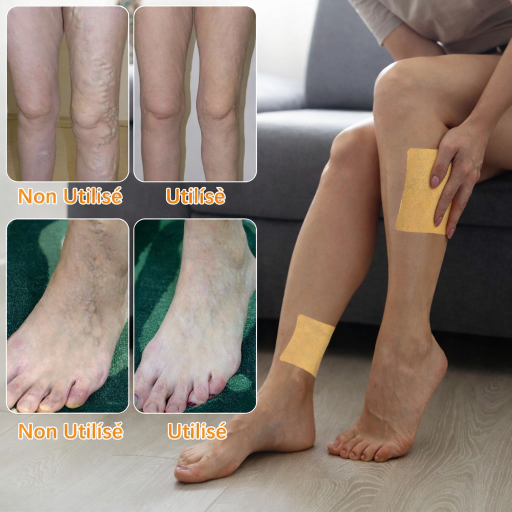 Pack ( 2 Boites 24 patchs ) Patchs pour soulager les varices